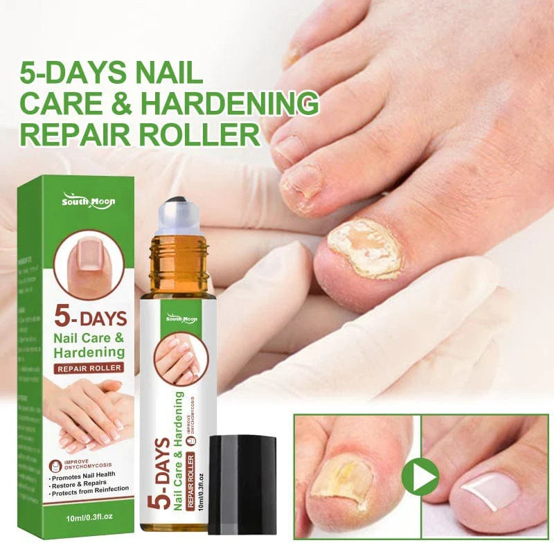 Treatment for toenail and fingernail fungus within 5 days.