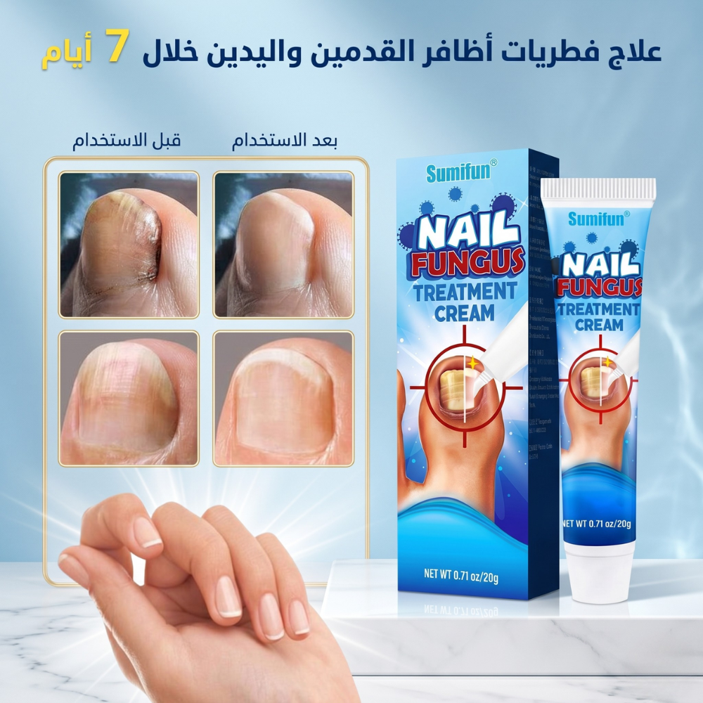 علاج فطريات أظافر القدمين واليدين خلال 7 أيام